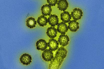 H1N1_Influenza_Virus_Particles_(8411599236)