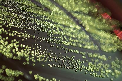Escherichia_coli_EMB (1)