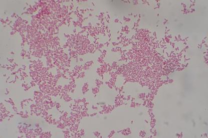 Escherichia_coli_Gram_Stain