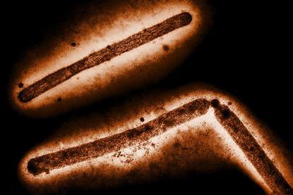 Influenza_A_H5N1_Virus_Particles