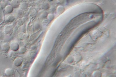 Aspergillus_ustus_Hulle_cell