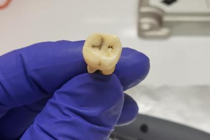 Low-Res_Jerash tooth 2 - May 2022 - Credit Greg O'Corry FAU-Crowe