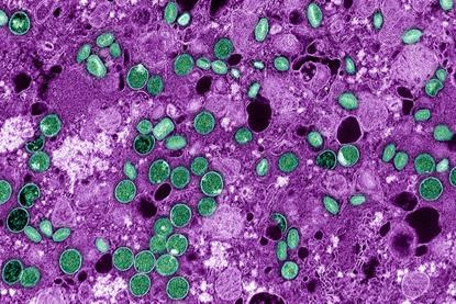 Mpox_Virus_-_53922109282 (1)