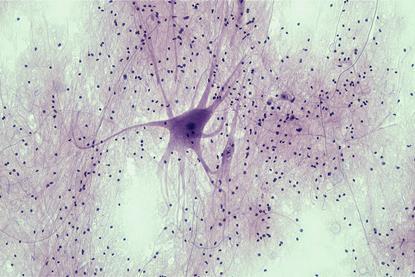 Nervous_Tissue_Spinal_Cord_Motor_Neuron_(41850849912)
