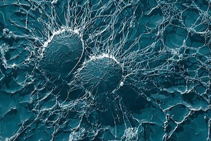 Staphylococcus_aureus,_50,000x,_USDA,_ARS,_EMU