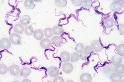 Trypanosoma-evansi-rat-blood-Giemsa-stain