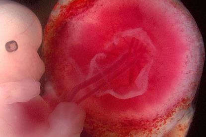Fetus_and_placenta_-_journal.pbio.0060312.g001