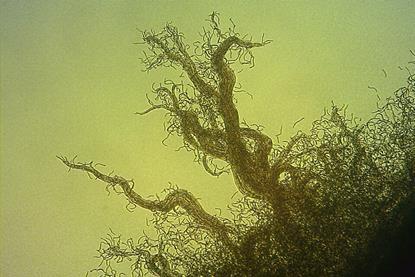 Nostoc_with_hormogonia_40x