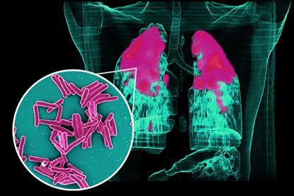 Mycobacterium_Tuberculosis_Bacteria,_the_Cause_of_TB_(52764953115)