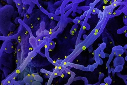 Novel_Coronavirus_SARS-Cov-2_(50010746961)