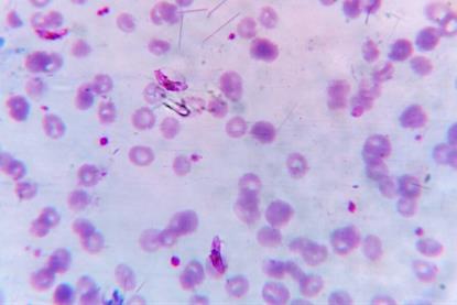 Plasmodium_falciparum_gametocyte