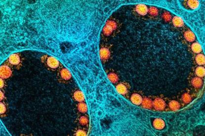 Low-Res_COVID-19 NIAID