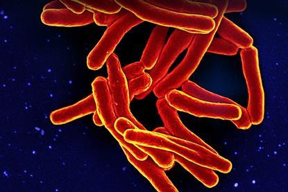 Mycobacterium_Tuberculosis_Bacteria,_the_Cause_of_TB_(52766723188)