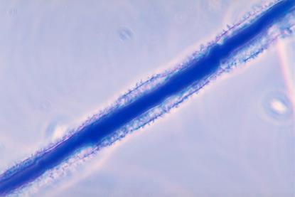 Aspergillus_flavus_01