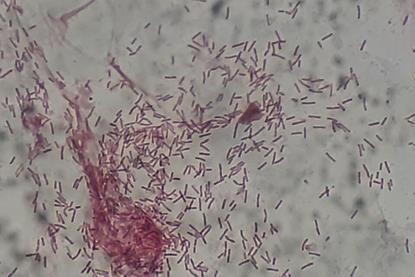 Gram_negative_rods_(GNRs)_of_Pseudomonas_aeruginosa_in_Gram_staining_of_BAL