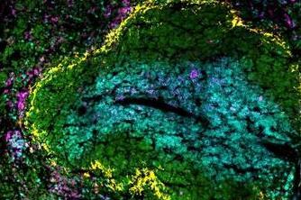 Low-Res_efecte-vacunes-mes-enlla-infeccio