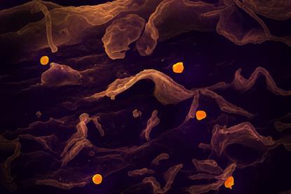 Nipah_Virus_(47965850372)