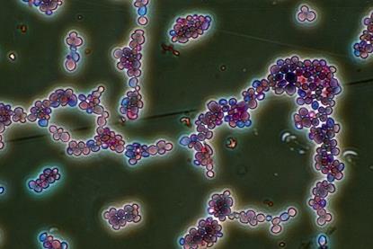 Candida_albicans_(251_12)