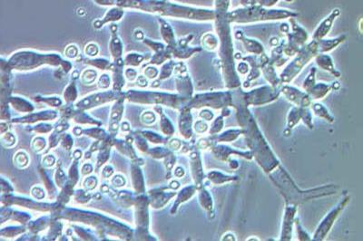 Trichoderma_harzianum