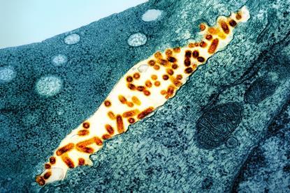 Vesicular_Stomatitis_Virus_(VSV)_particles_(orange)_found_in_extracellular_space_and_budding_from_the_plasma_membrane_of_infected_cells_(teal)