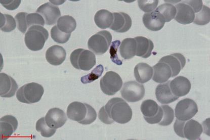 P.falciparum-gametocytes