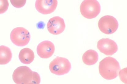 Blood_smear_of_Babesia_microti,_original (1)