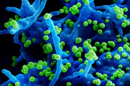 Lassa_Virus_-_51719109817