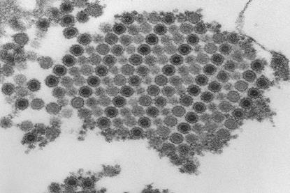 960px-Chikungunya_virus_particles-PHIL-17369