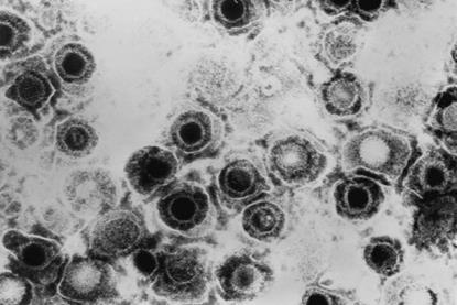 Herpes_simplex_virus_TEM_B82-0474_lores