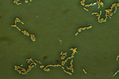 Escherichia_coli_(257_06)_Gramnegative_rods (1)