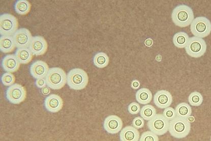 Cryptococcus_neoformans_using_a_light_India_ink_staining_preparation_PHIL_3771_lores