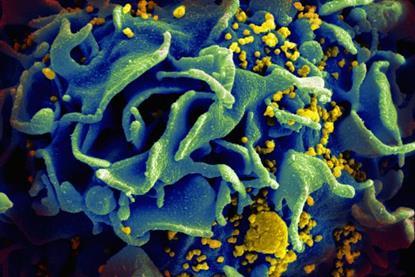 HIV-infected_T_cell_(6813489183)