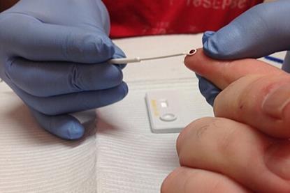 HIV_Rapid_Test_being_administered