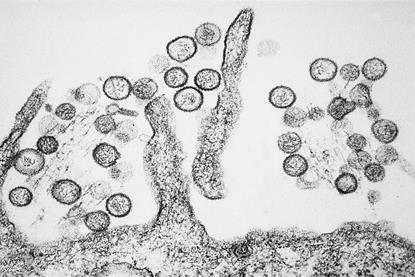 Sin_Nombre_hanta_virus_TEM_PHIL_1136_lores