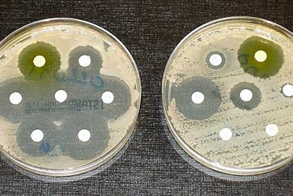 E. coli antibiotic_sensitivity_and_resistance