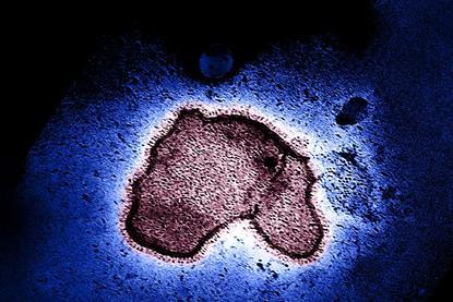 Human_Respiratory_Syncytial_Virus_(RSV)_-_2111