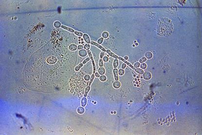 Candida_albicans_1964