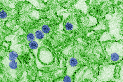Zika_EM_CDC_20541