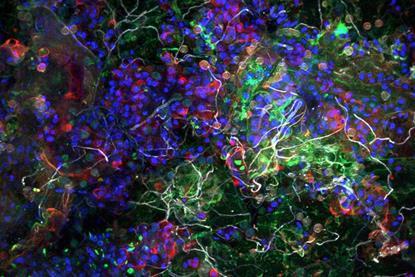 Low-Res_PM_Biofilm ©Thomas Neu UFZ