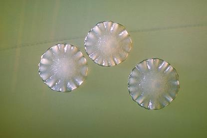 Actinomyces_spp_01