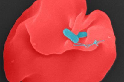 Low-Res_Bartonella bacilliformis_1000x1000c_Juergen_Berger_MPl_Biology_Tuebingen