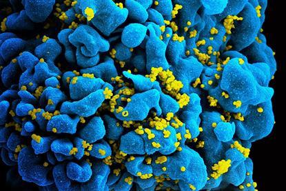 HIV-infected_T_cell_(6813384933)