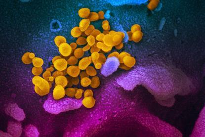 SARS-CoV-2_(yellow)