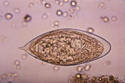 Schistosoma_haematobium_egg_4843_lores
