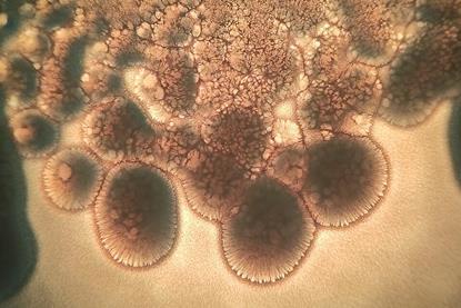 Beautiful_Bacillus_subtilis_bacterial_growth_under_the_microscope_06