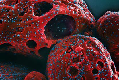 Novel_Coronavirus_SARS-CoV-2_(Omicron)_(52488777518)