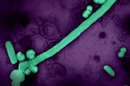 Influenza_A_Virus_(H3N2)