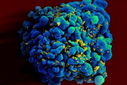 HIV-infected_H9_T_cell