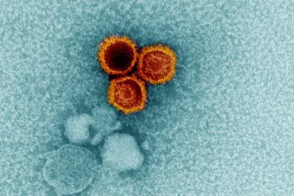 Epstein-Barr_Virus_(EBV)_Particles