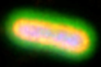 Low-Res_Klebsiella pneumoniae